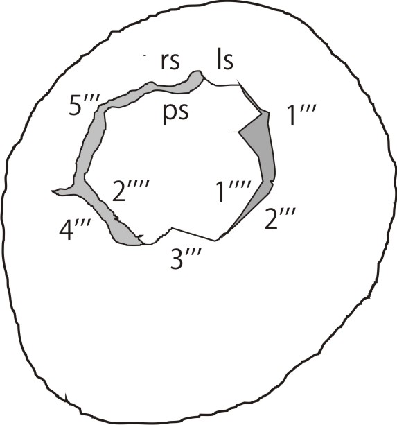 Guler et al., 2005. Caligodinium perforatum 02.jpg