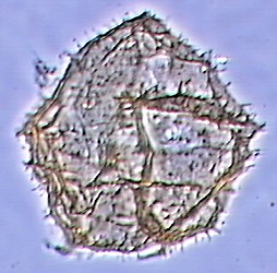 Trinovantedinium glorianum.jpg