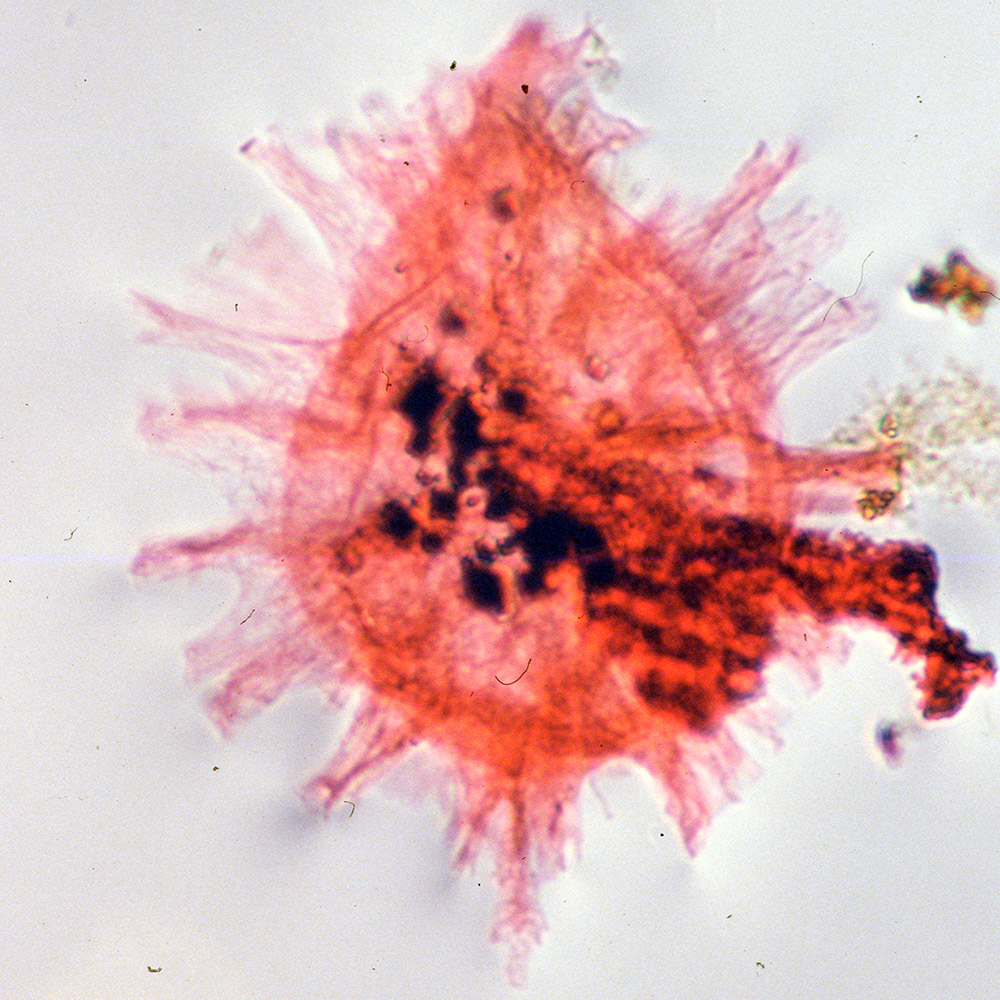 Fibrocysta bipolaris.jpg