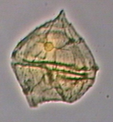 Palaeoperidinium cretaceum.jpg