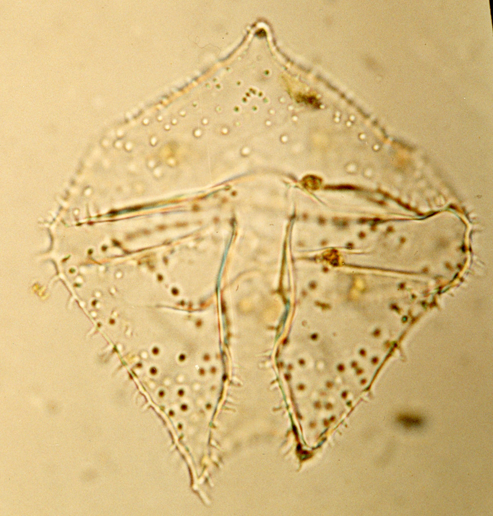 Trinovantedinium applanatum.jpg