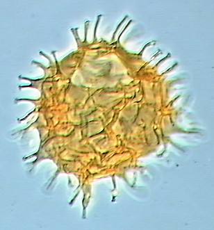 Apectodinium homomorphum.jpg