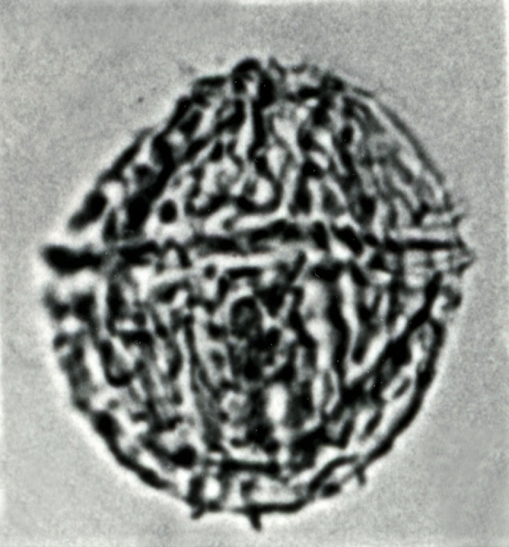 Ellipsodinium rugulosum.jpg