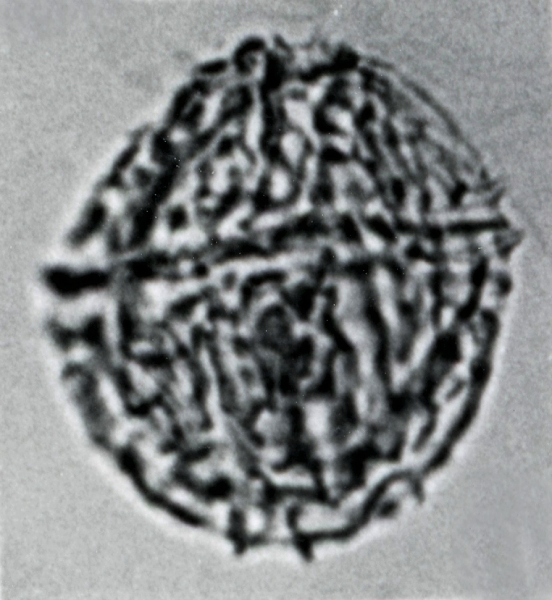 Ellipsodinium rugulosum.jpg