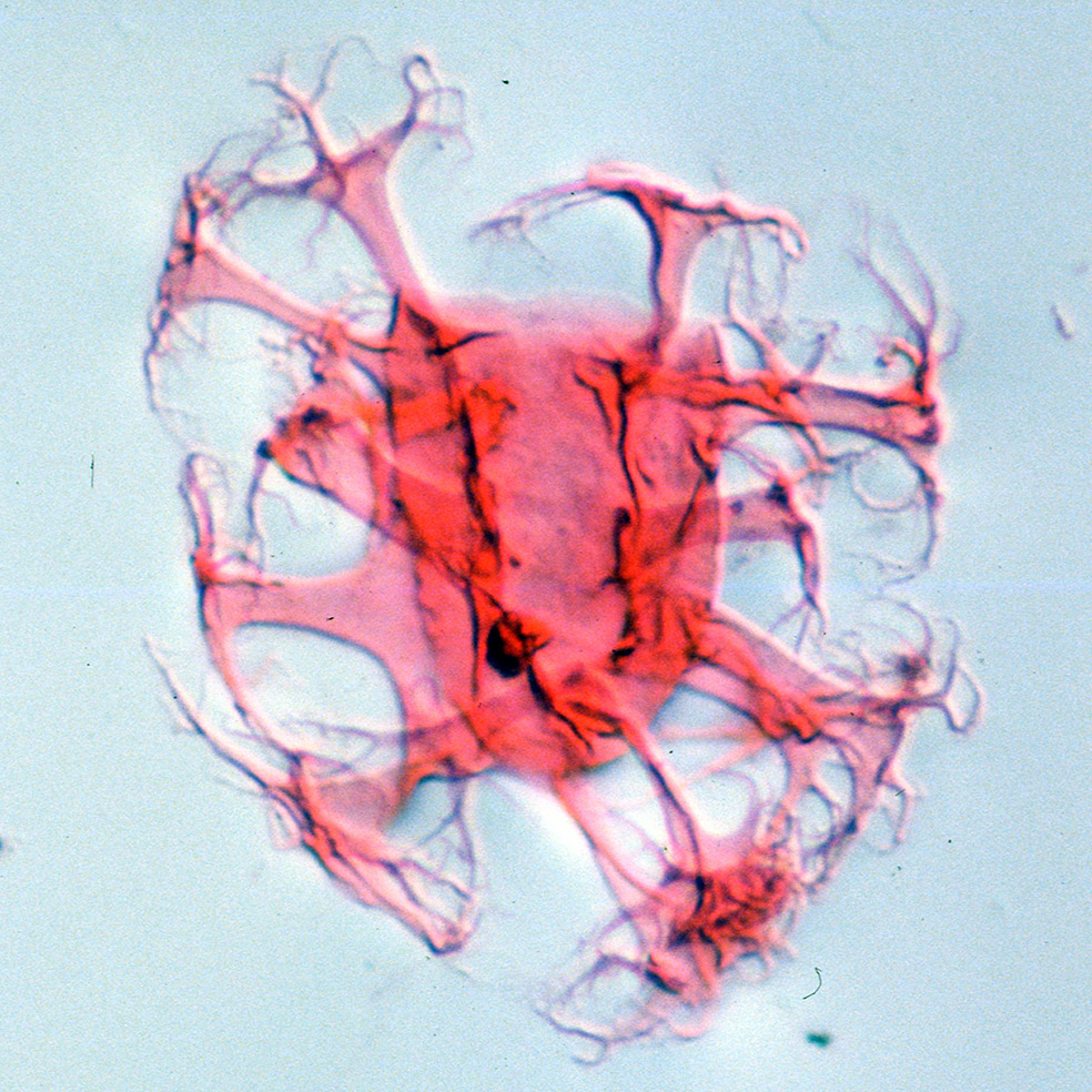 Distatodinium paradoxum.jpg