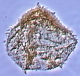 Trinovantedinium glorianum.jpg