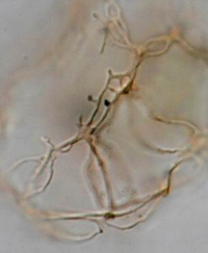 Nematospaheropsis rigida 02.jpg