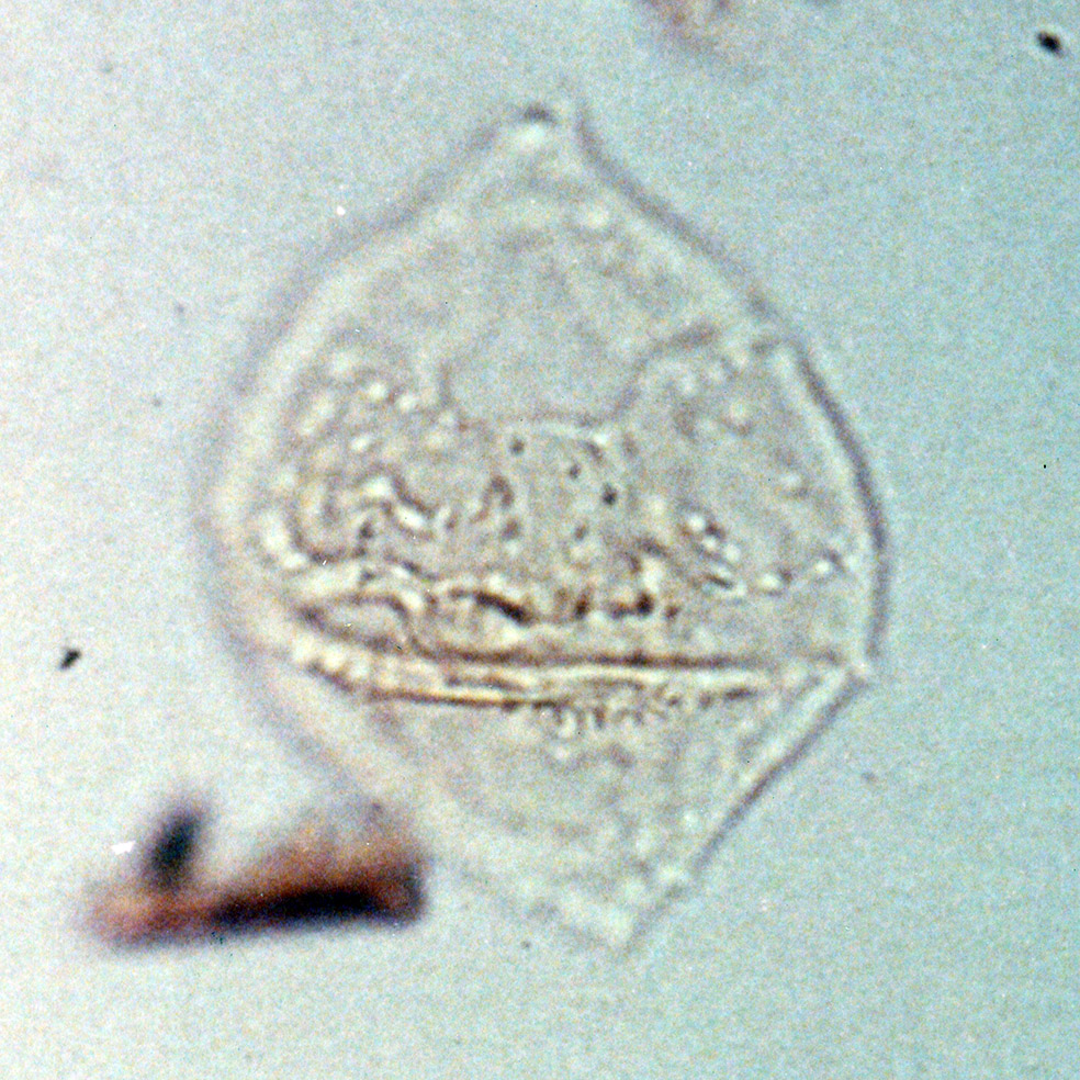 Spinidinium boydii.jpg