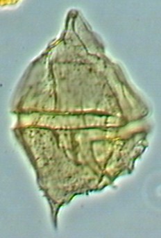 Palaeoperidinium cretaceum.jpg