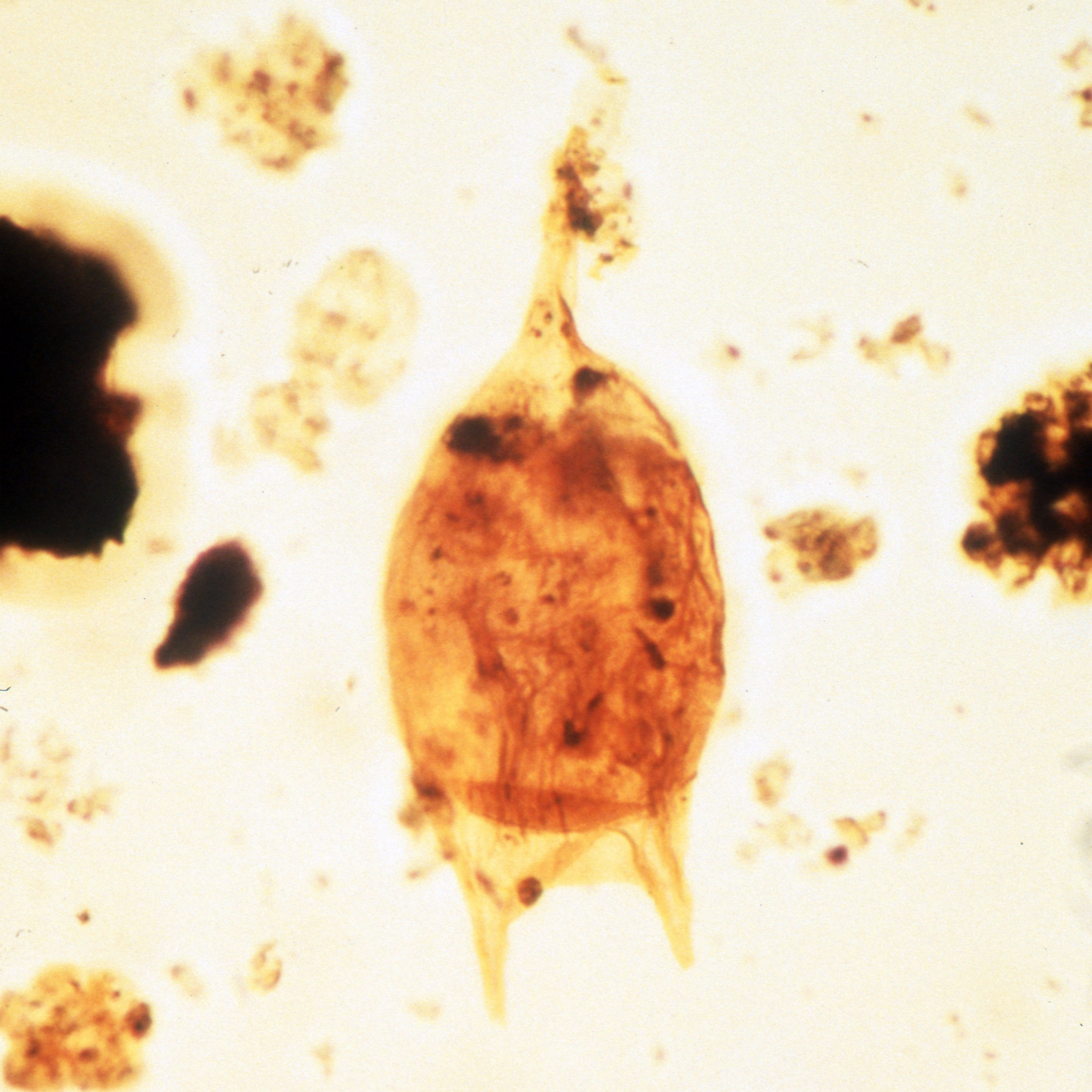 000010_Ceratiopsis_leptoderma_holotype copy.jpg