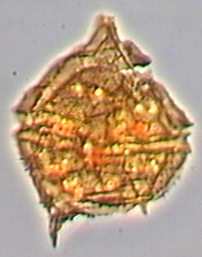 Palaeoperidinium cretaceum.jpg