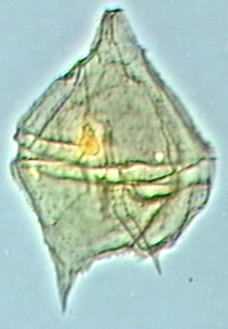 Palaeoperidinium cretaceum.jpg