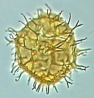 Apectodinium homomorphum.jpg