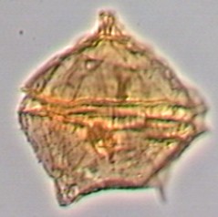 Palaeoperidinium cretaceum.jpg