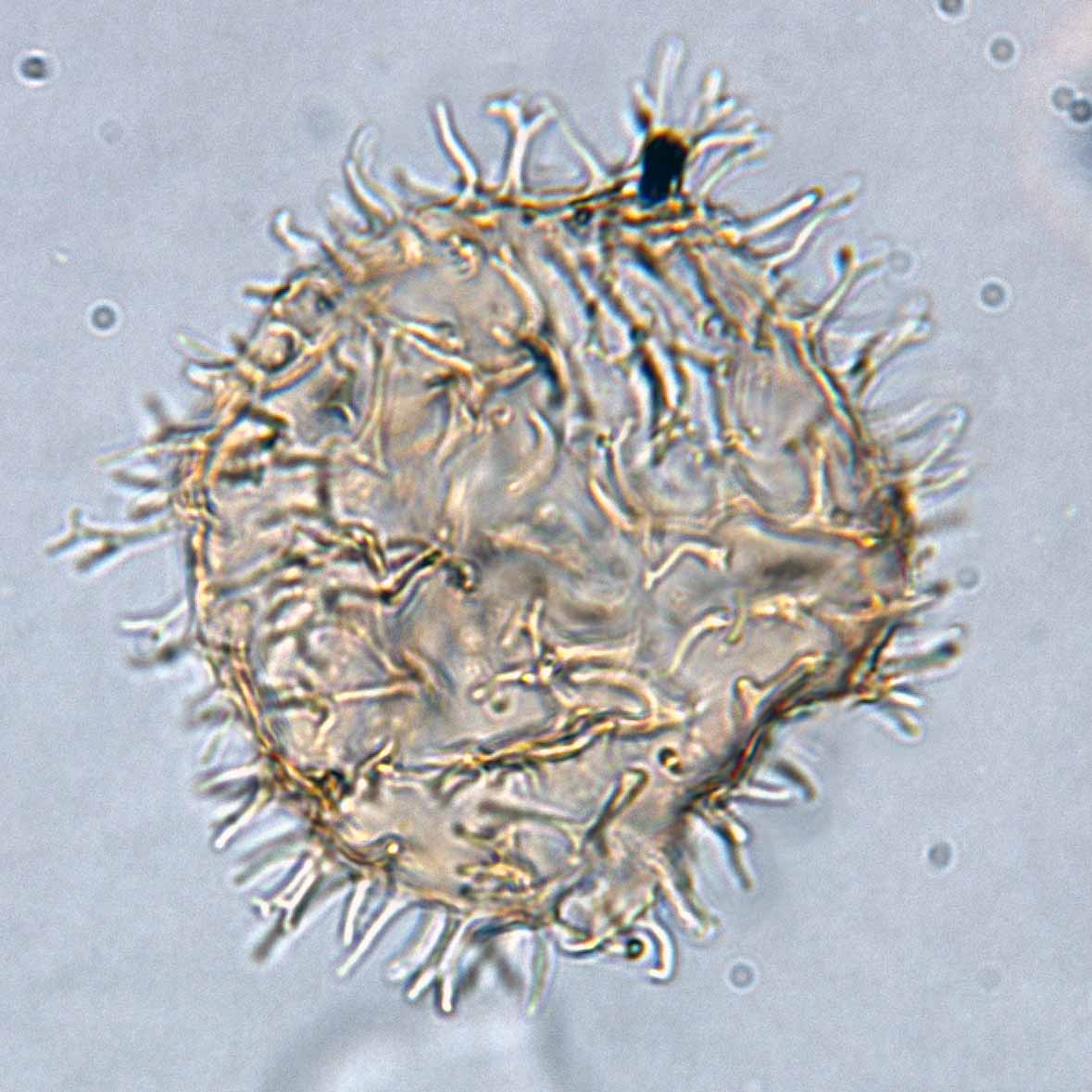 Apectodinium homomorphum.jpg