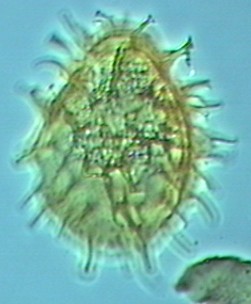 Exochosphaeridium majus.jpg