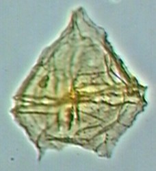 Palaeoperidinium cretaceum.jpg