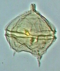 Palaeoperidinium cretaceum.jpg