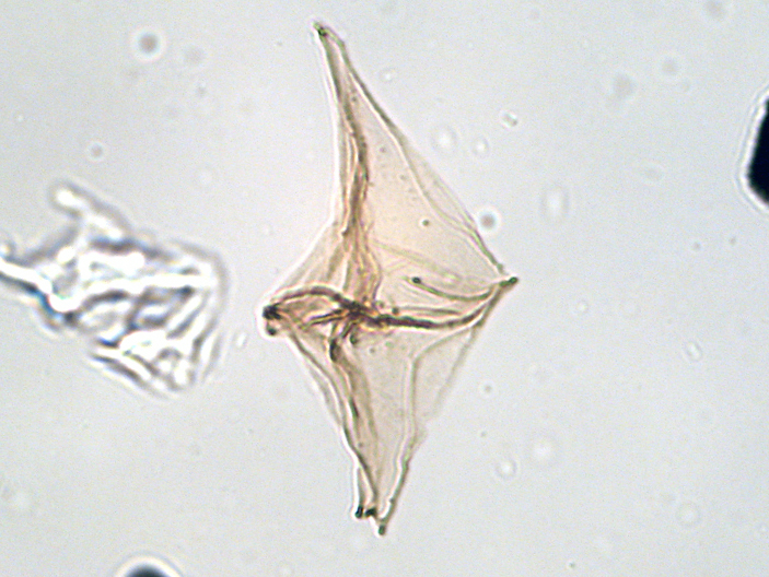 Lejeunecysta sp. 94R-4W 4-1011.jpg