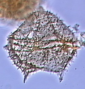 Trinovantedinium glorianum.jpg