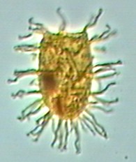 Tanyosphaeridium xanthiopyxides.jpg