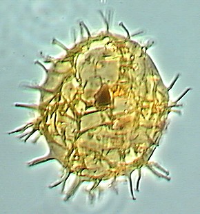 Apectodinium homomorphum.jpg