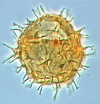 Apectodinium homomorphum.jpg