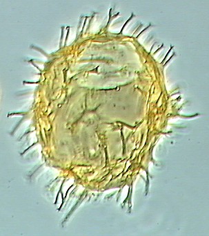 Apectodinium homomorphum.jpg