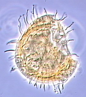 Operculodinium centrocarpum.jpg