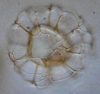 Nematospaheropsis rigida 01.jpg