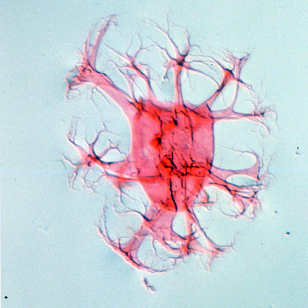 Distatodinium paradoxum.jpg