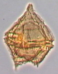 Palaeoperidinium cretaceum.jpg