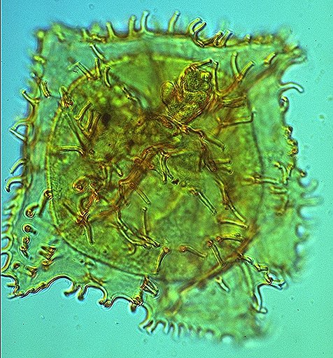 Vallodinium echinosuturatum.jpg