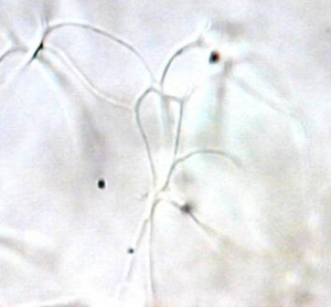 Nematospaheropsis rigida 03.jpg