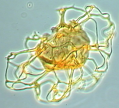 Adnatosphaeridium filiferum.jpg