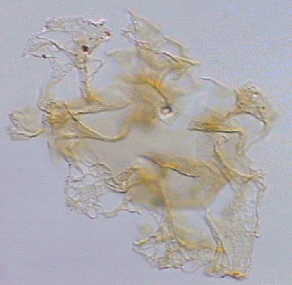 Adnatosphaeridium paucispinum.jpg