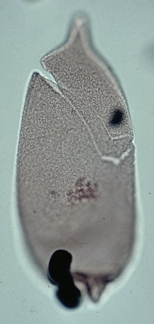 Batioladinium micropodum.jpg