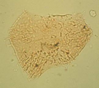 Circulodinium attadalicum.jpg