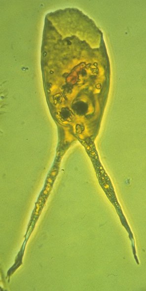 Batioladinium longicornutum.jpg