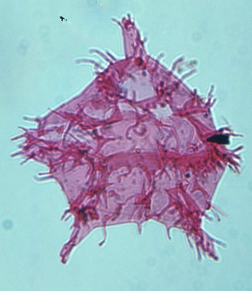 Apectodinium homomorphum.jpg